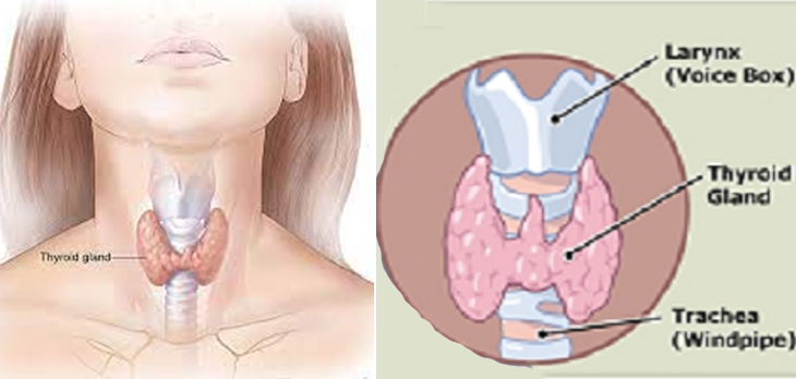 what is thyroid gland problems treatment